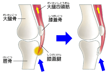 ABE58B9F-E429-4776-9B59-1B7D518B0C1B