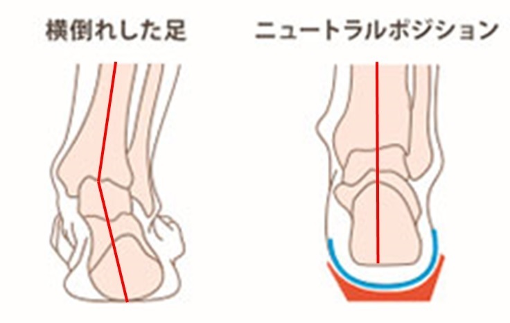 回内足A